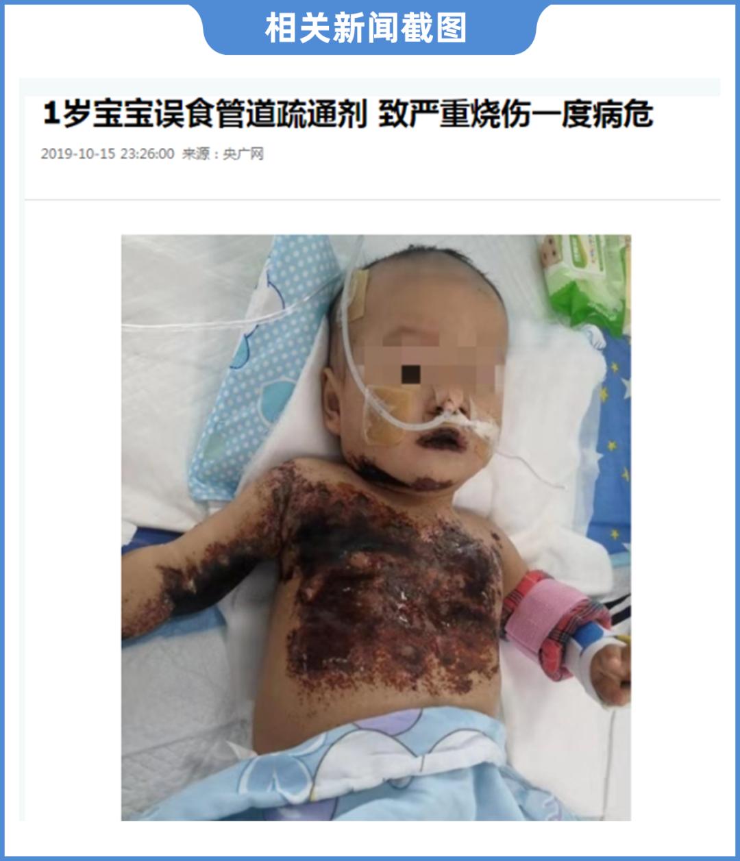 管道疏通剂用法_管道疏通剂强碱性腐蚀皮肤_管道疏通剂误食风险
