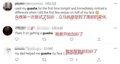 刮痧美容在海外火起来 老外被这“神秘的东方力量”折服 | 星尘资源网