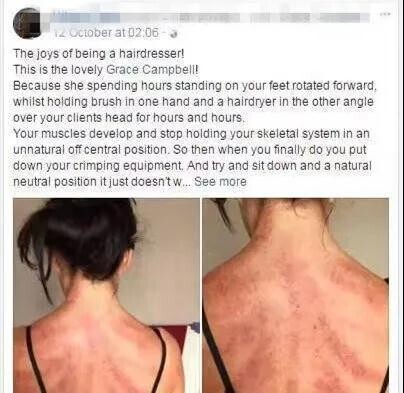 刮痧方法教程_刮痧美容效果_guasha benefits
