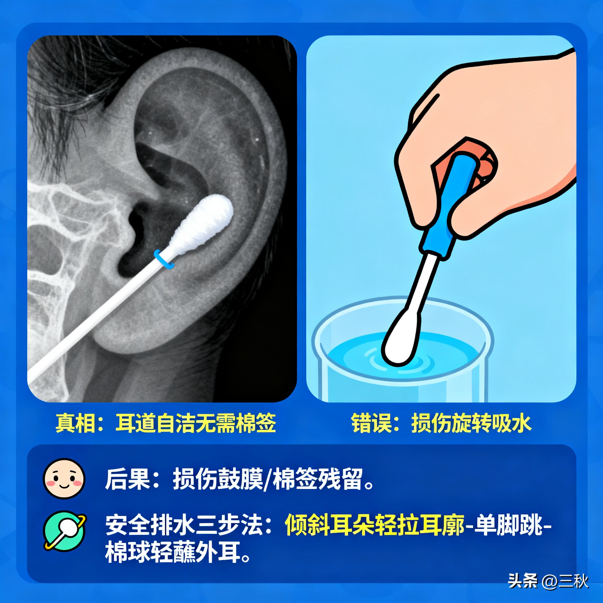 掏耳误区_儿科护理常识_宝宝耳道护理