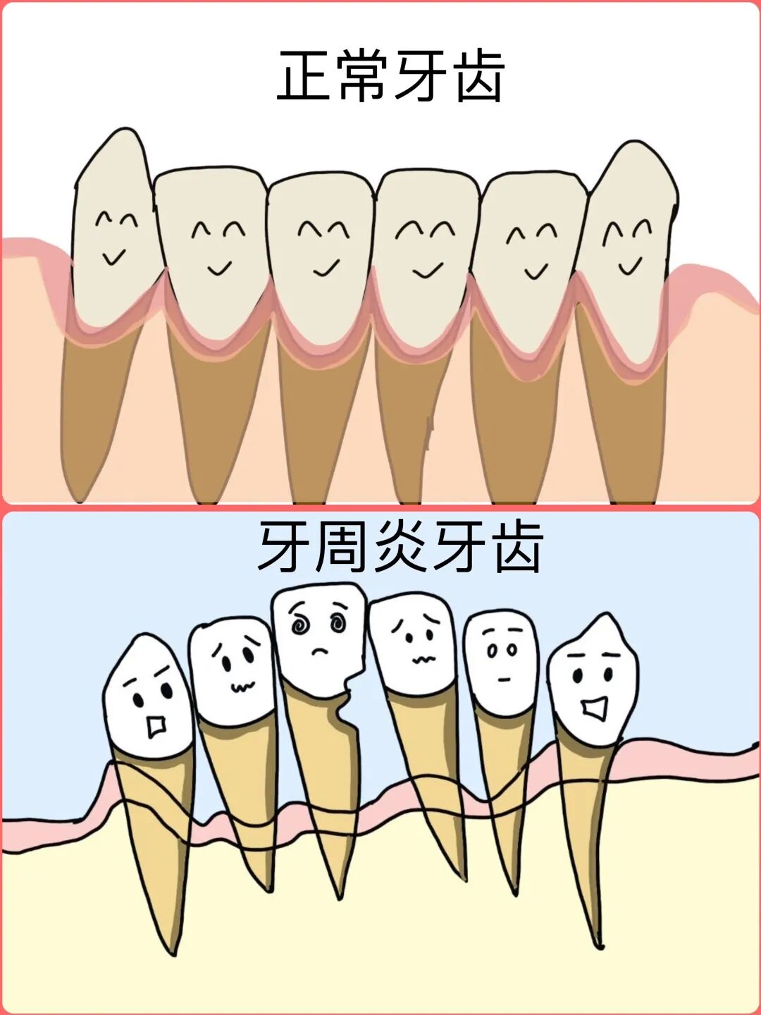 老年人口腔健康护理_牙周炎预防治疗_牙周炎预防