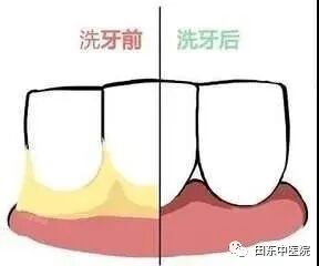 长期牙齿健康问题困扰_牙周炎预防_蛀牙牙龈肿痛口腔溃疡牙周炎预防