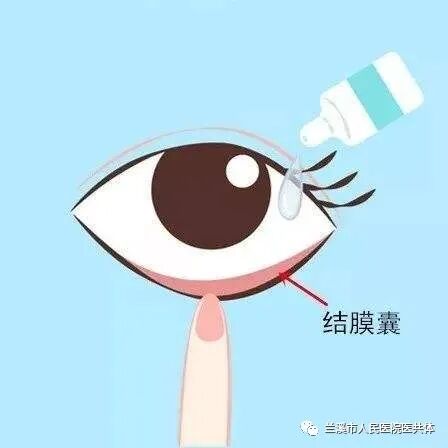眼药膏使用方法_眼药水使用_眼药水使用方法