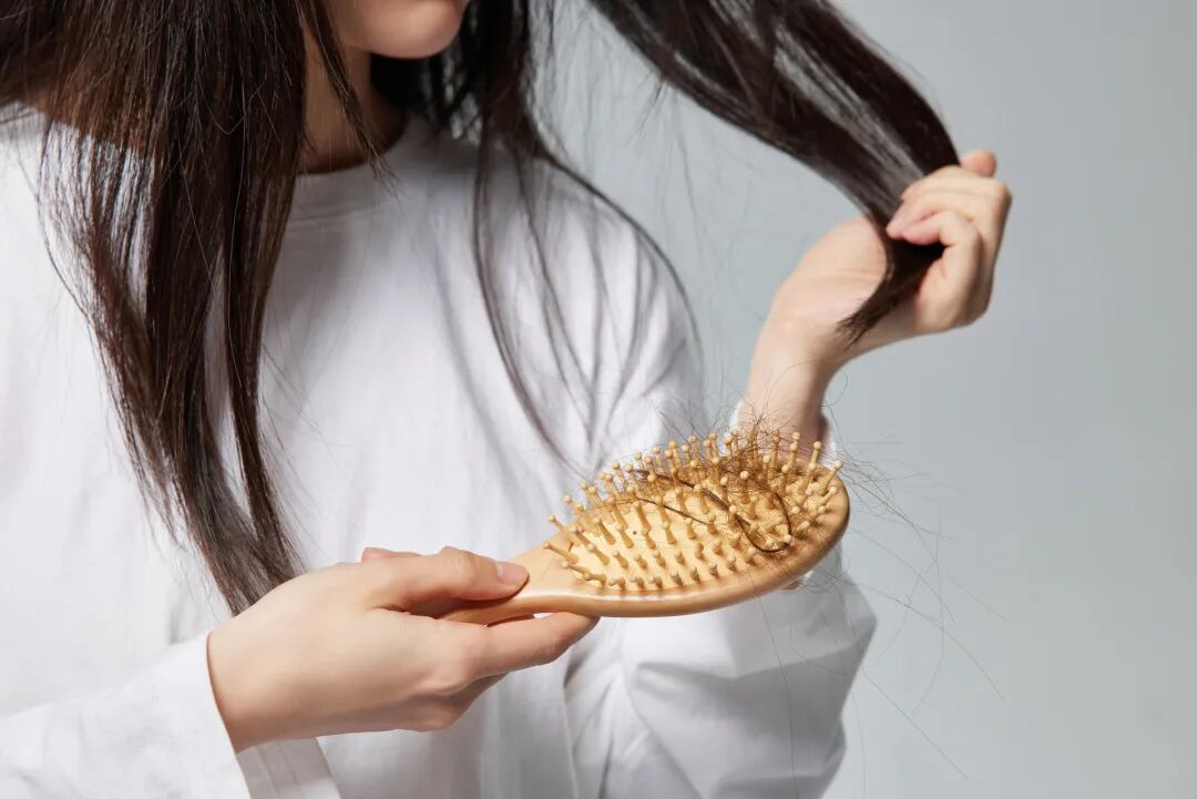 区分脱发与正常掉发_脱发原因_脱发预防技巧