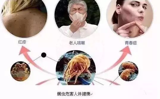 床垫螨虫清洁_除螨服务_床垫除螨步骤