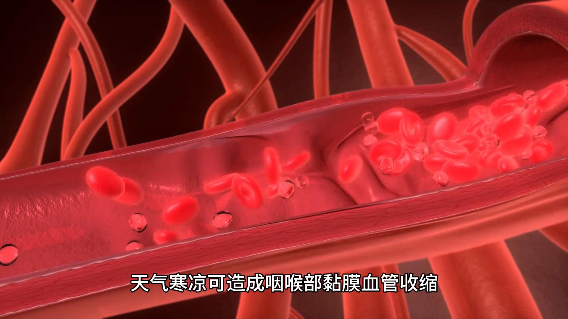 咽炎缓解技巧_咽炎症状_急性咽炎治疗