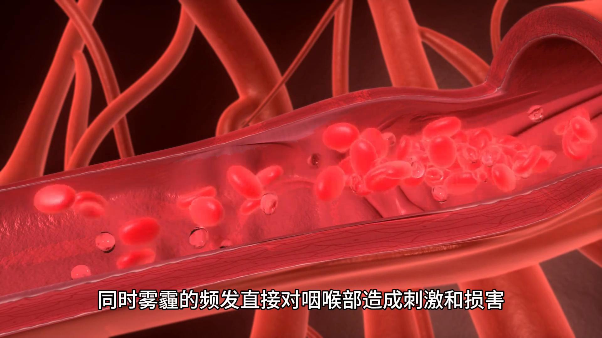 咽炎缓解技巧_急性咽炎治疗_咽炎症状