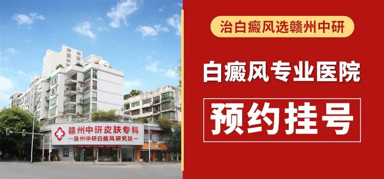 白癜风社交技巧_季节性皮肤护理_皮肤护理方法