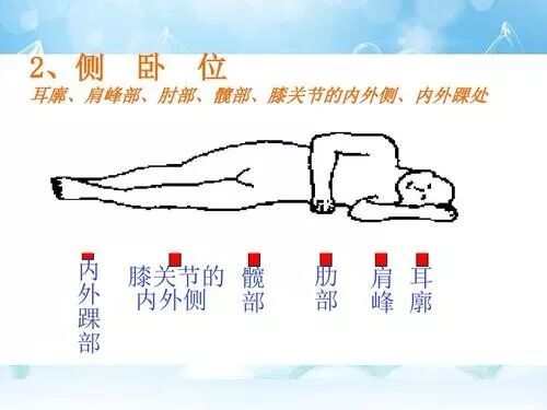压疮概念定义_耳部护理常识_压疮产生原因分析