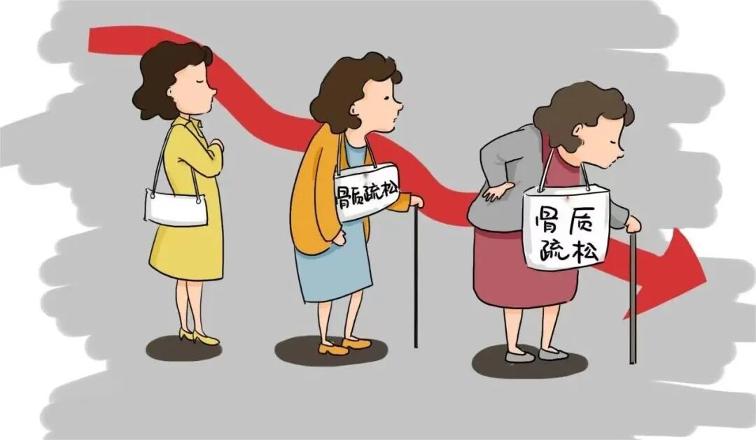 预防骨质疏松,补钙就可以了吗?|科普时间 | 星尘资源网