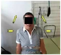 钟摆运动肩关节康复_肩周炎锻炼_肩关节活动度训练