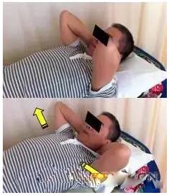 肩周炎锻炼_肩关节活动度训练_钟摆运动肩关节康复